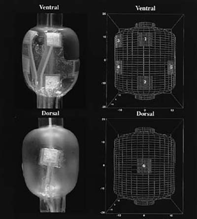 black and white image of an diagram relating to cardiac surgery