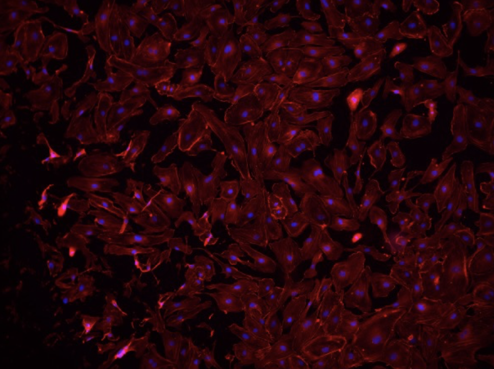 Human kidney glomerular microvascular endothelial cells