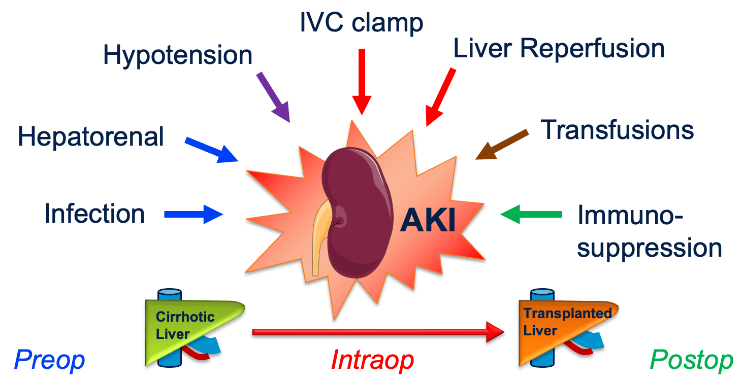 Transplant Anesthesia Research Group diagram