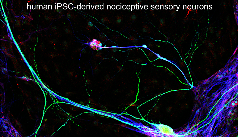 Sensory neurons