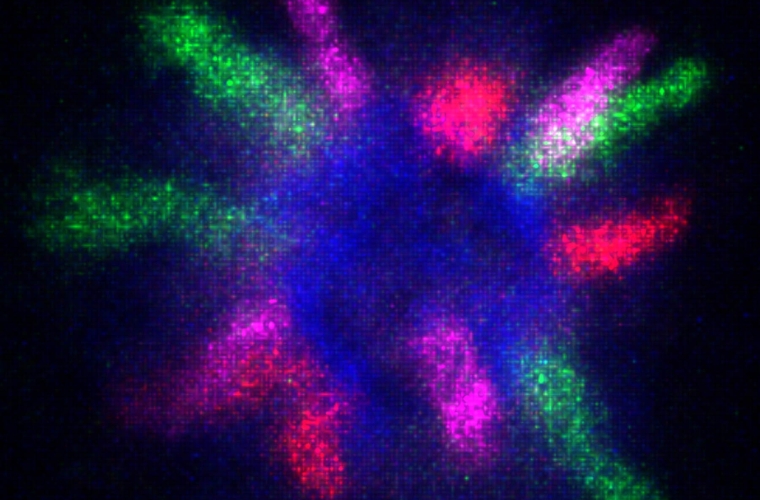 A prometaphase chromosome rosette of a mouse tetraploid myoblast cell.