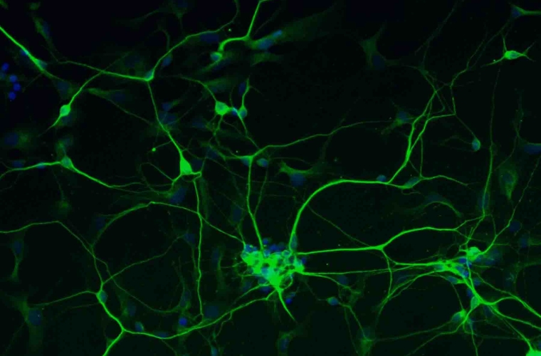 Human stem cell derived neuron