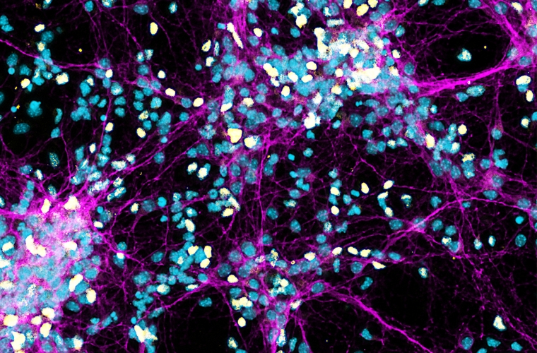 Neural progenitor cells from a mouse cortex forming connections as they mature into young neurons in vitro
