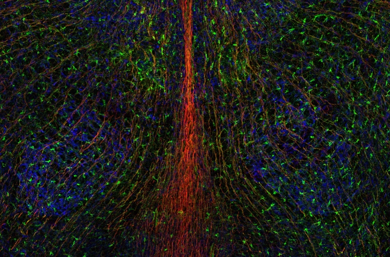Neural stem cells anchored at ventricles (green layer, top) at the center of the brain, and extend processes that radially transverse the entire brain (green/red fibers).