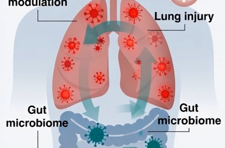 Gut-lung axis diagram showing inflammation, immune modulation, lung injury, and gut microbiome.