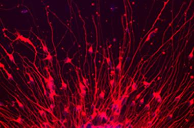 neurons emerging from a neurosphere aditi deshpande