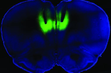 Laser light delivered through fiberoptic cables directed at the prefrontal cortex (shown here by their tracks) is used to modulate firing activity of neurons expressing light-sensitive molecules (shown in green fluorescence) to regulate cocaine-seeking behavior in rats.