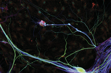 iPSC-derived sensory neurons 