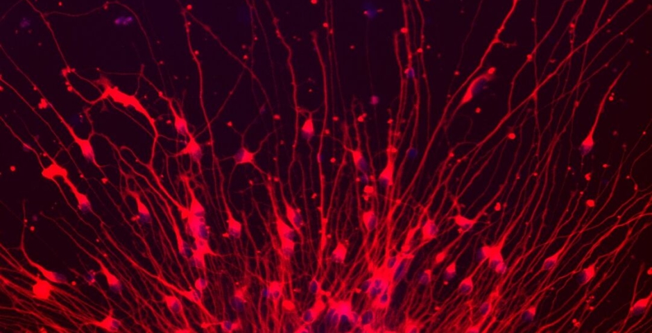 Newly born neurons (brain cells) migrate away from a neurosphere in culture, which is an aggregation of precursors of neurons and other brain cells