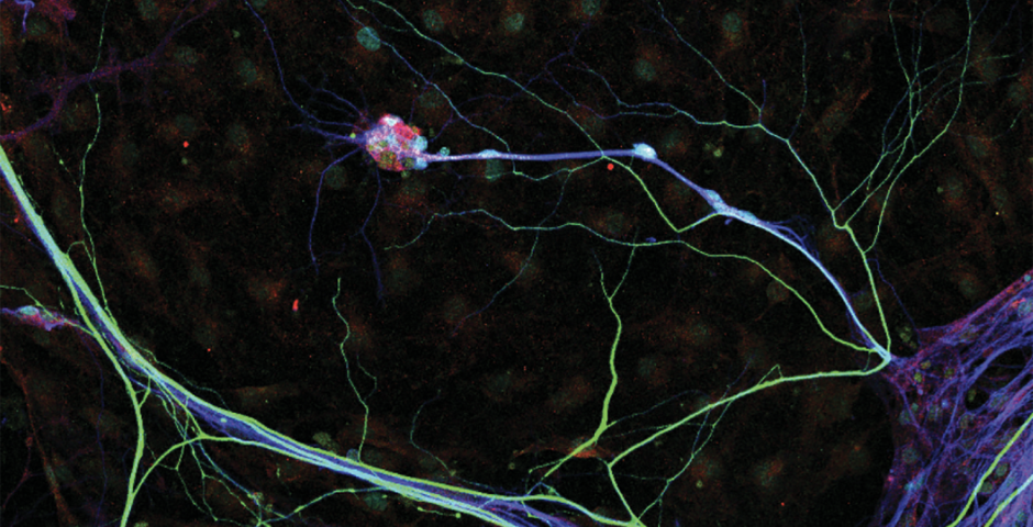 iPSC-derived sensory neurons 