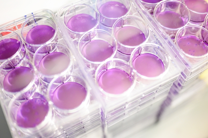 Petri dishes with a purple filling