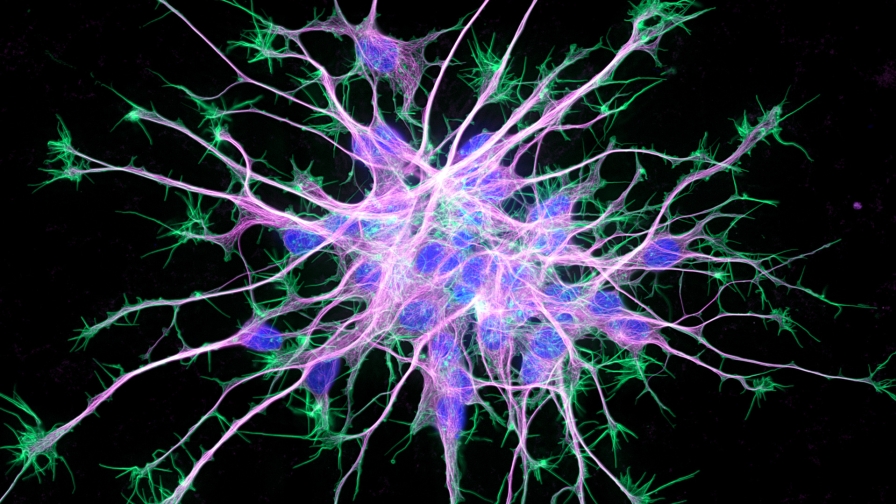 Cytoskeleton in neurons differentiating from induced pluripotent stem cells.