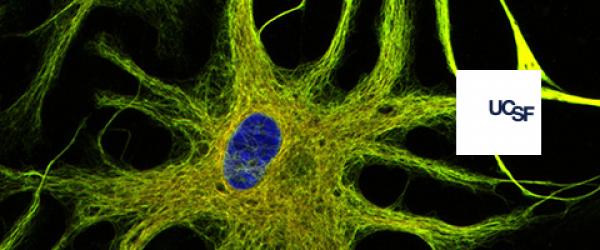 Pictured are human astrocytes immunostained for glial fibrillary acidic protein (GFAP, yellow) which is an intermediate filament involved in the function and structure of cell's cytoskeleton. These particular astrocytes have been differentiated from human induced pluripotent stem (iPS) cells. Cell nuclei are labeled with Hoechst (blue).