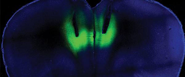 Laser light delivered through fiberoptic cables directed at the prefrontal cortex (shown here by their tracks) is used to modulate firing activity of neurons expressing light-sensitive molecules (shown in green fluorescence) to regulate cocaine-seeking behavior in rats.