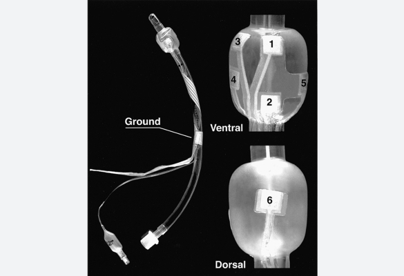 Figure 1 from January 2000 Anesthesiology article: Endotracheal Cardiac Output Monitor.