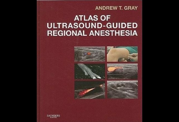 Atlas of Ultrasound-Guided Regional Anesthesia written by Andrew Gray.