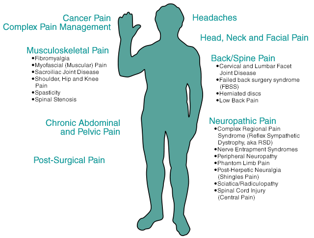 Figure showing the wide variety of conditions treated at the UCSF Pain Management Center